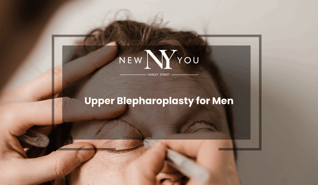 Upper Blepharoplasty for Men