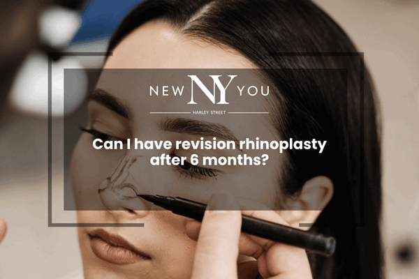 Can I have revision rhinoplasty after 6 months?