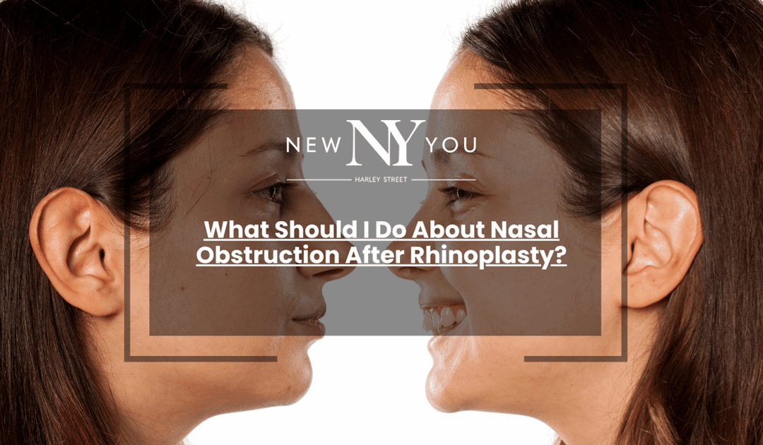 What Should I Do About Nasal Obstruction After Rhinoplasty?