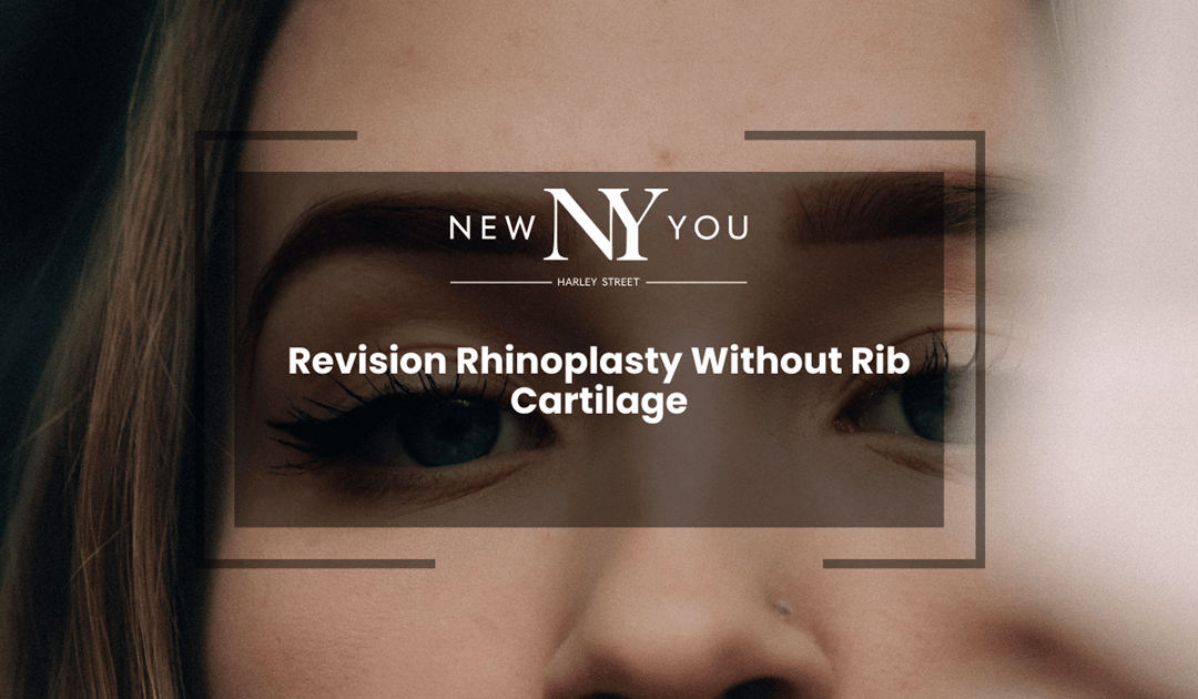 Revision Rhinoplasty Without Rib Cartilage