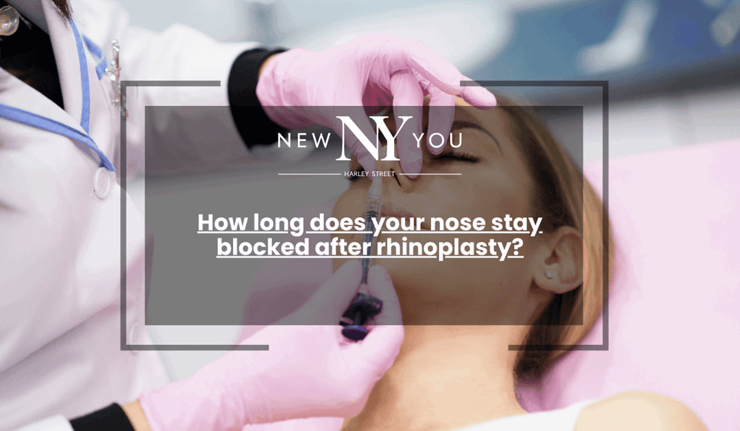 How long does your nose stay blocked after rhinoplasty?