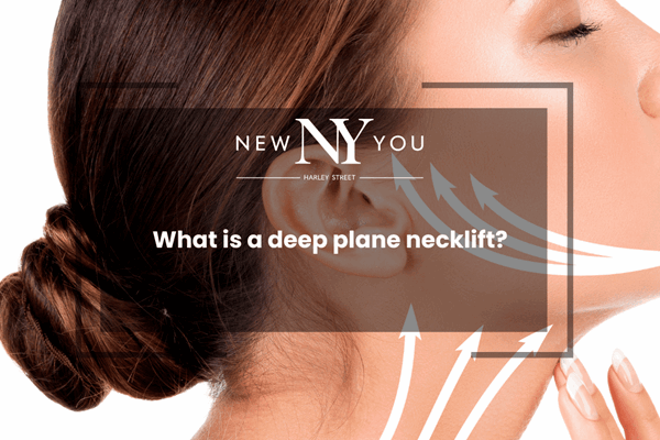 What is a deep plane necklift?