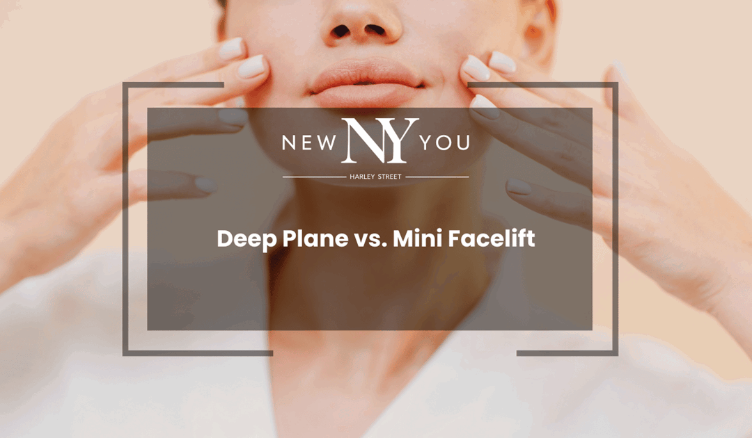 Deep Plane vs. Mini Facelift