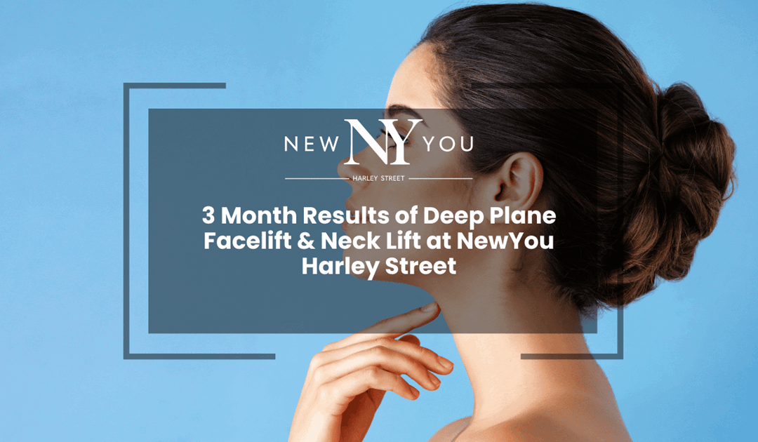 3 Month Results of Deep Plane Facelift & Neck Lift at NewYou Harley Street