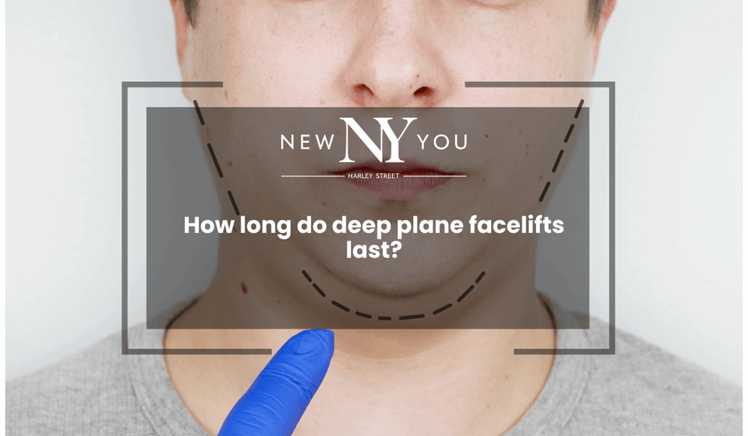 How long do deep plane facelifts last?