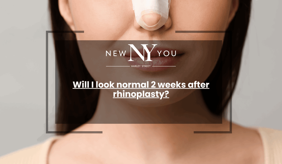 Will I look normal 2 weeks after rhinoplasty?