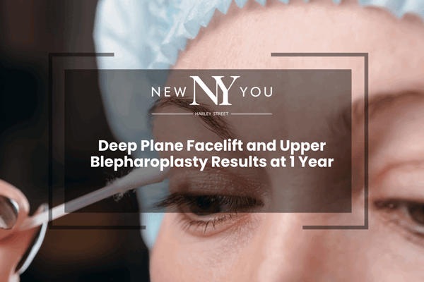 Deep Plane Facelift and Upper Blepharoplasty Results at 1 Year