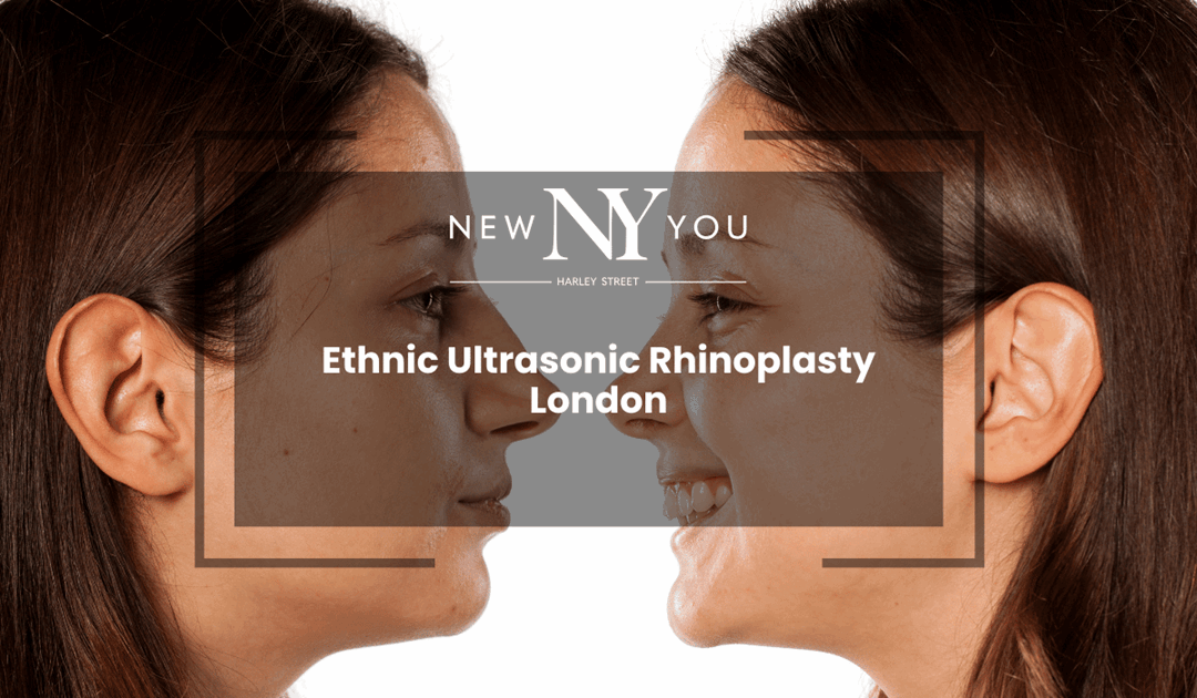 Ethnic Ultrasonic Rhinoplasty London