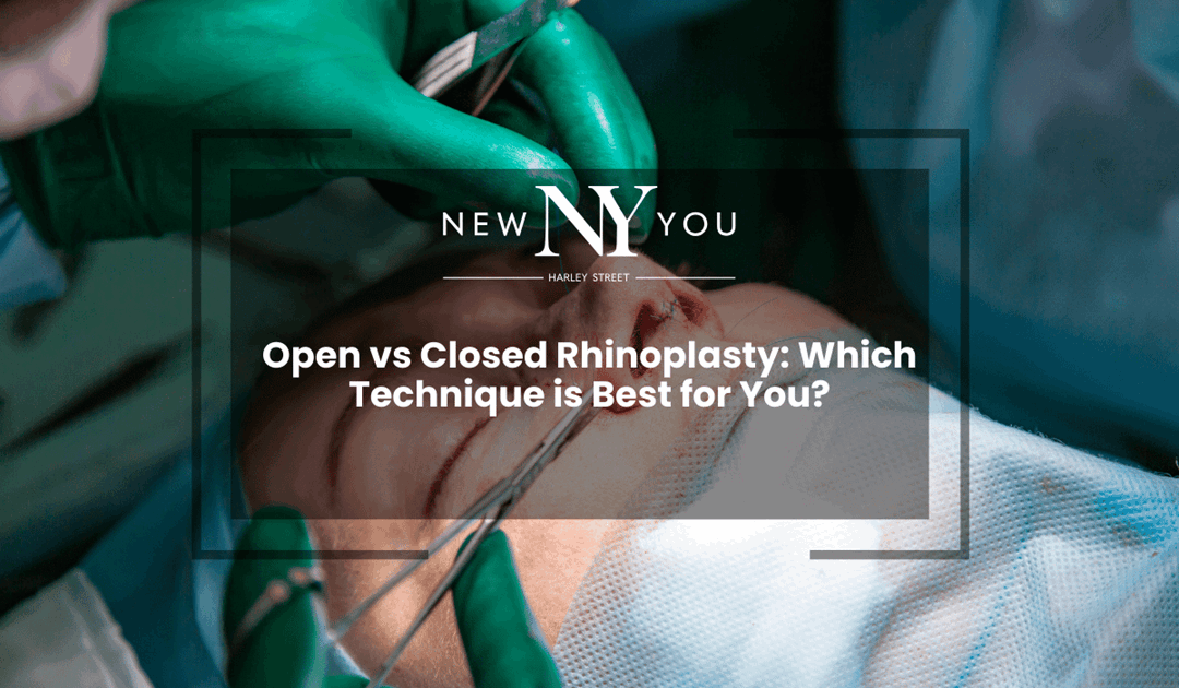 Open vs Closed Rhinoplasty: Which Technique is Best for You?