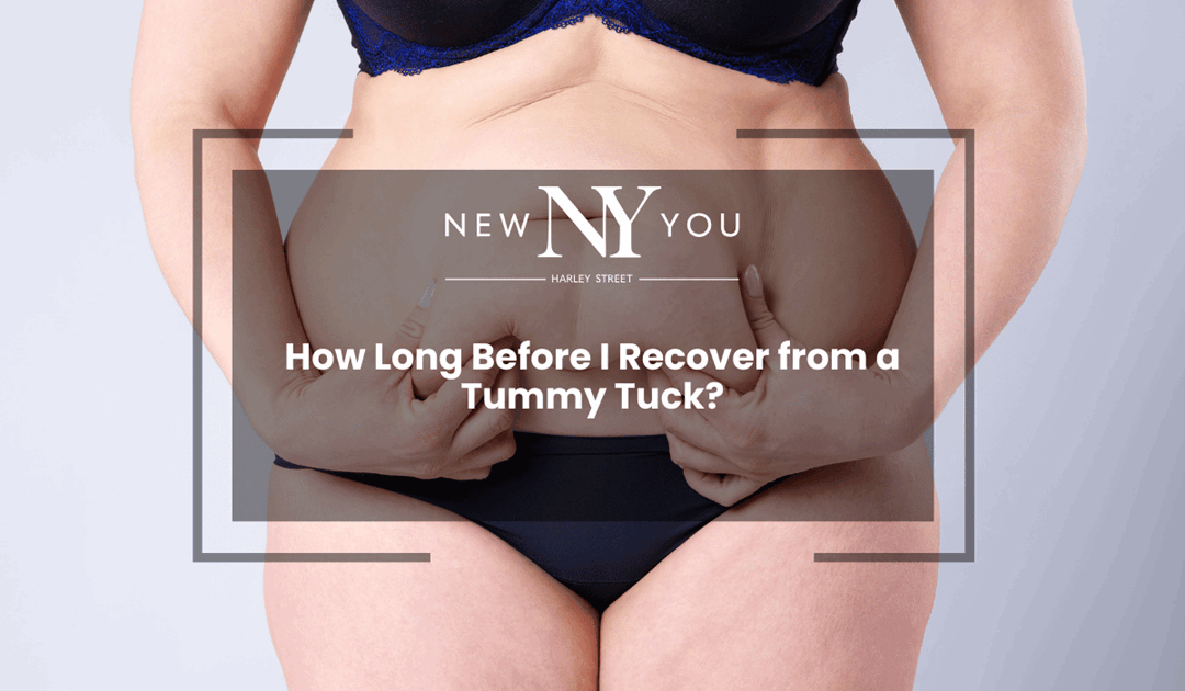 How Long Before I Recover from a Tummy Tuck?