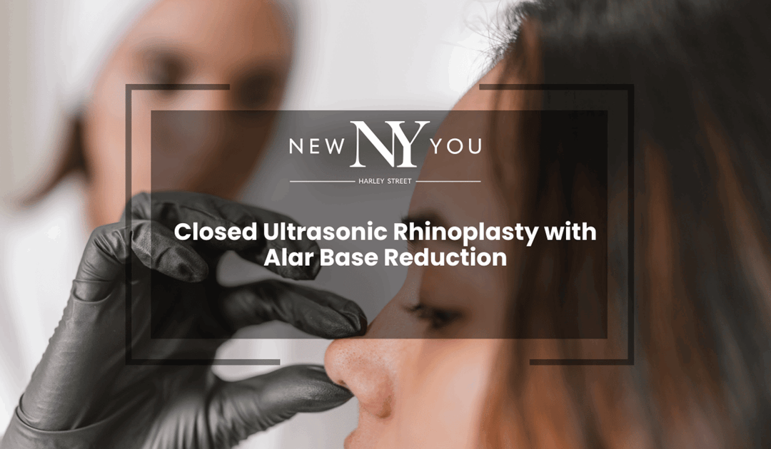 Closed Ultrasonic Rhinoplasty with Alar Base Reduction