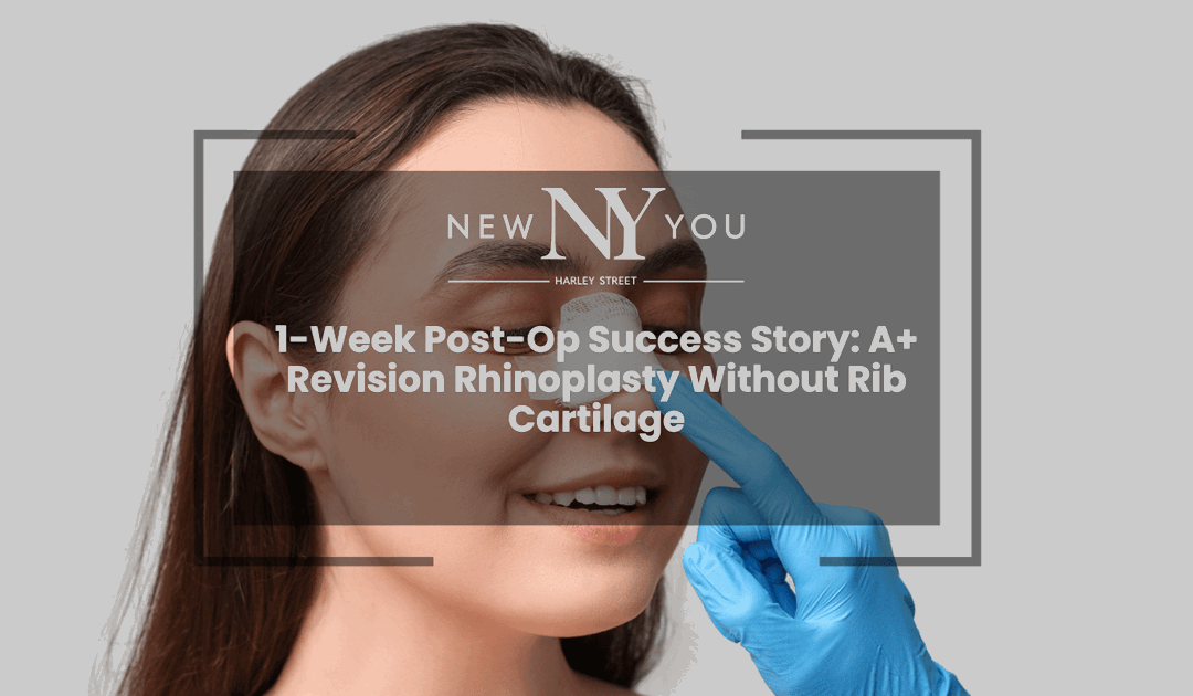 1-Week Post-Op Success Story: A+ Revision Rhinoplasty Without Rib Cartilage